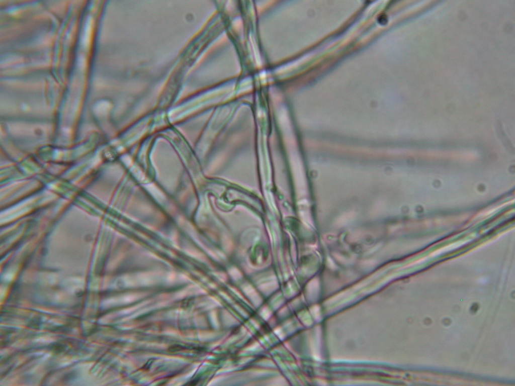 Da determinare...  (Dacryobolus karstenii)
